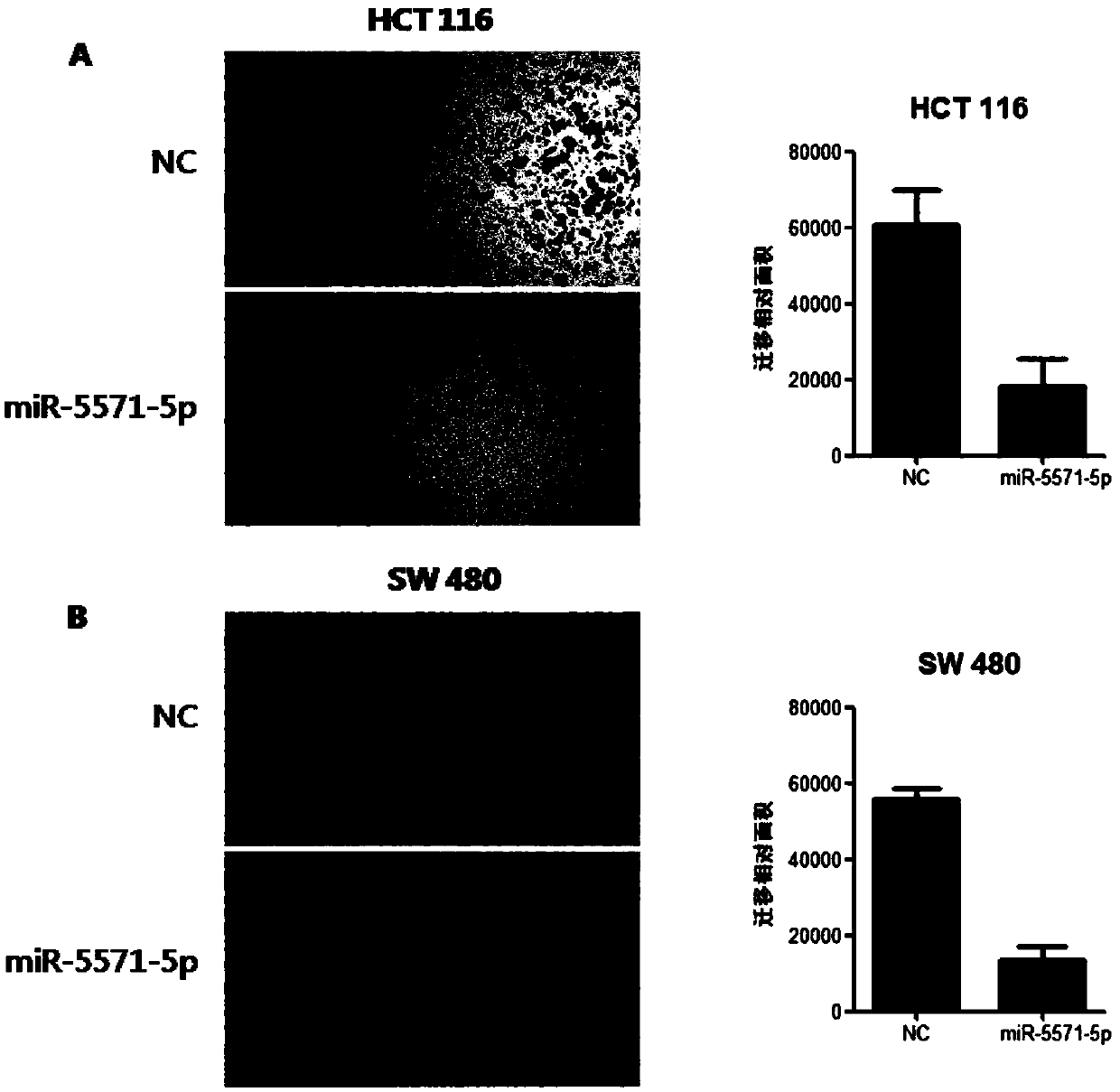 Application of miRNA-5571 in preparation of drugs for resisting colorectal tumor