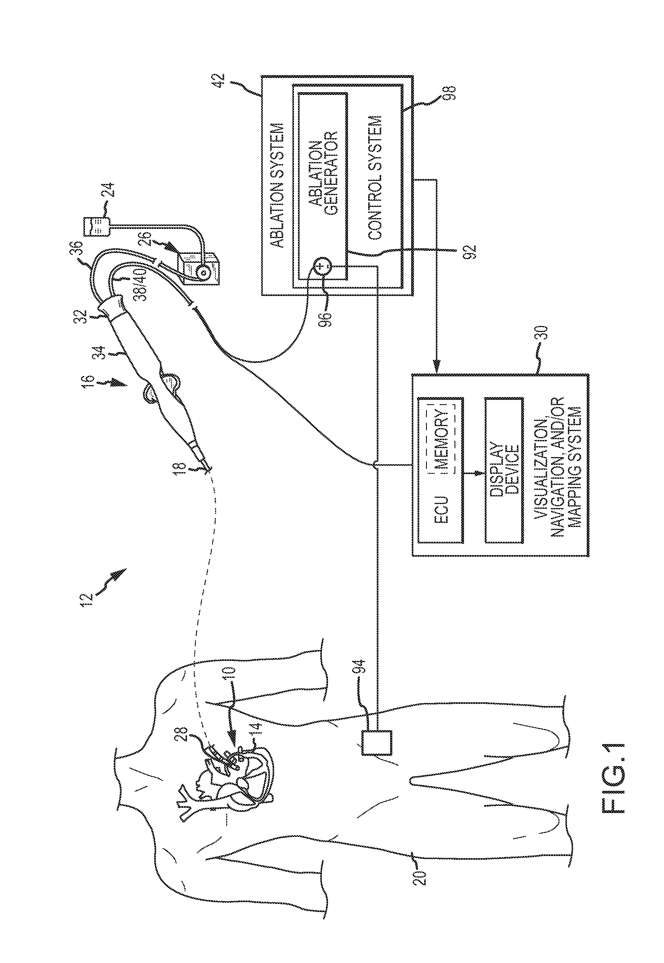 Irrigant distribution system for electrodes