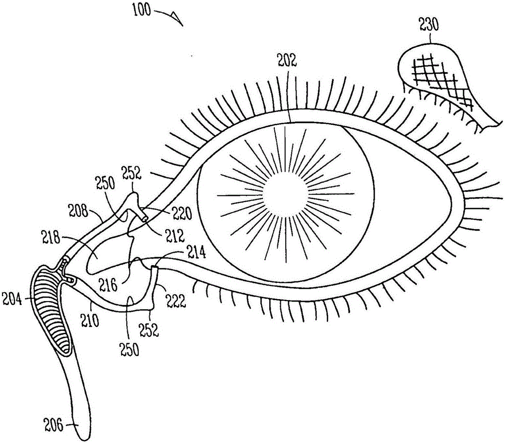 Lacrimal implants