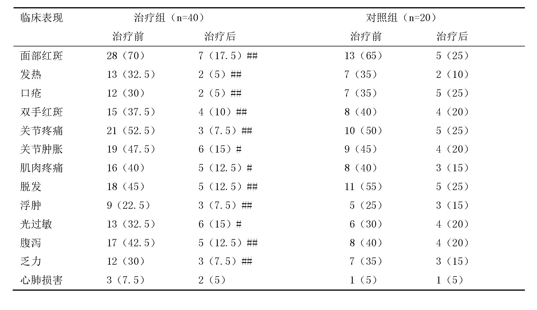 Chinese medicinal composition for treating systemic lupus erythematosus