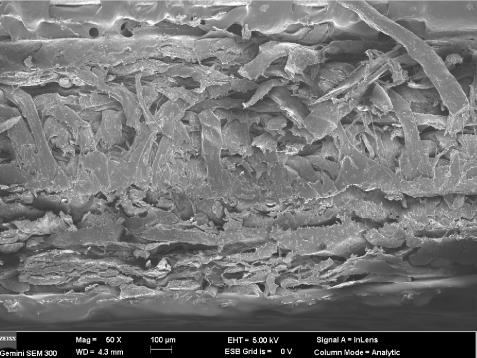 Preparation method of non-woven fabric for X-ray and gamma-ray protection