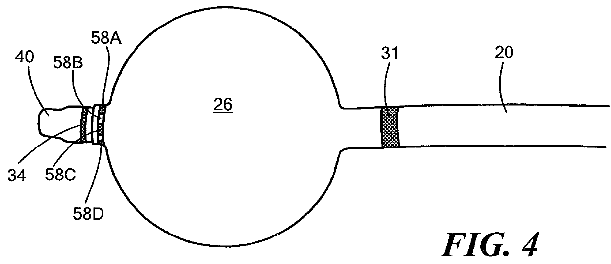 Distal balloon impedance and temperature recording to monitor pulmonary vein ablation and occlusion