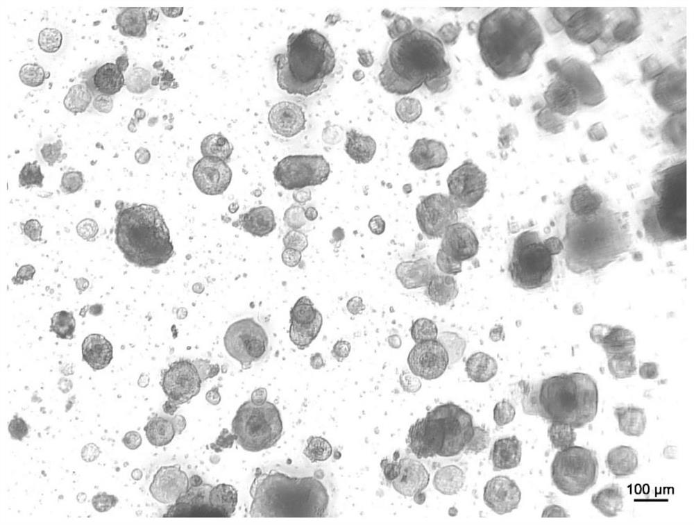 Culture medium, method and kit for rapidly culturing tumor organoids