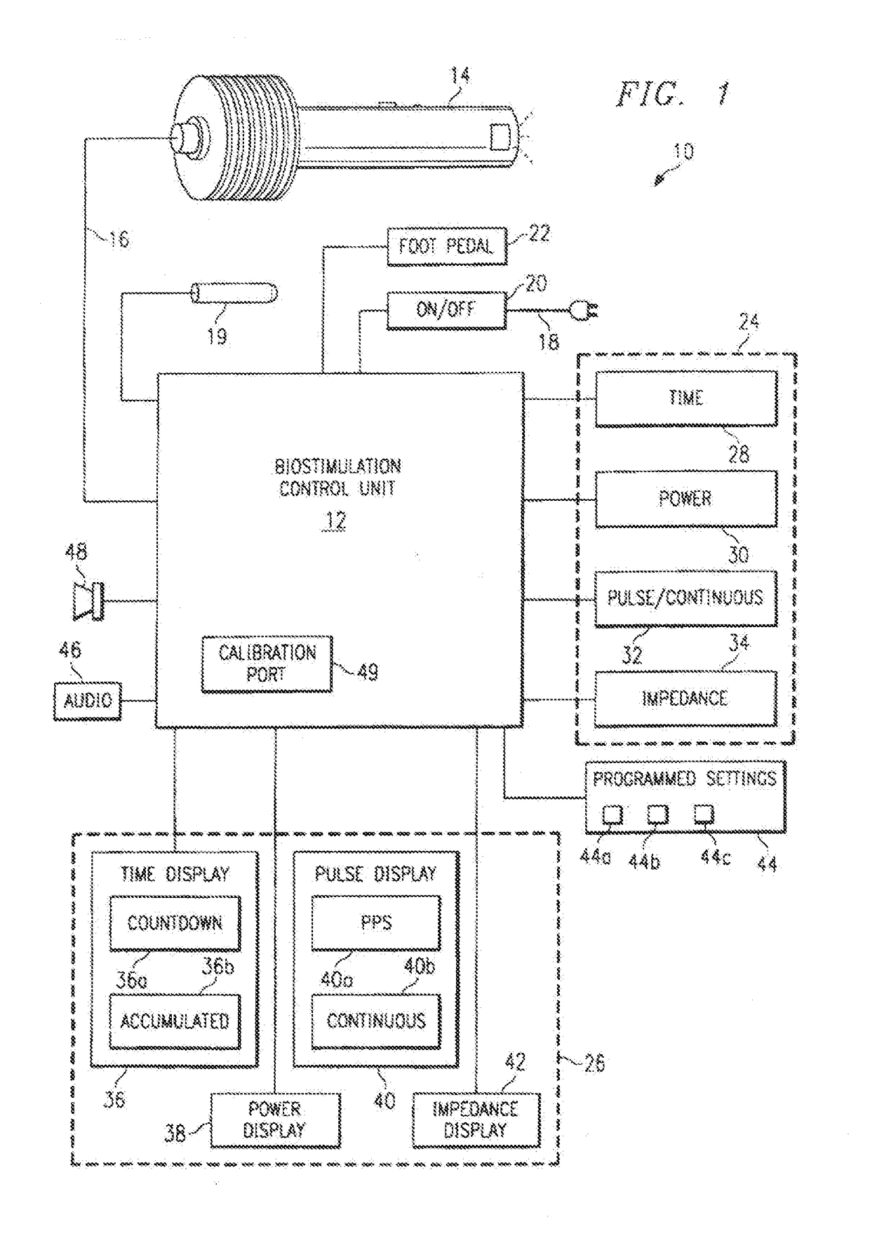 Method and System for Appetite Suppression by Laser Stimulation of Acupuncture Points