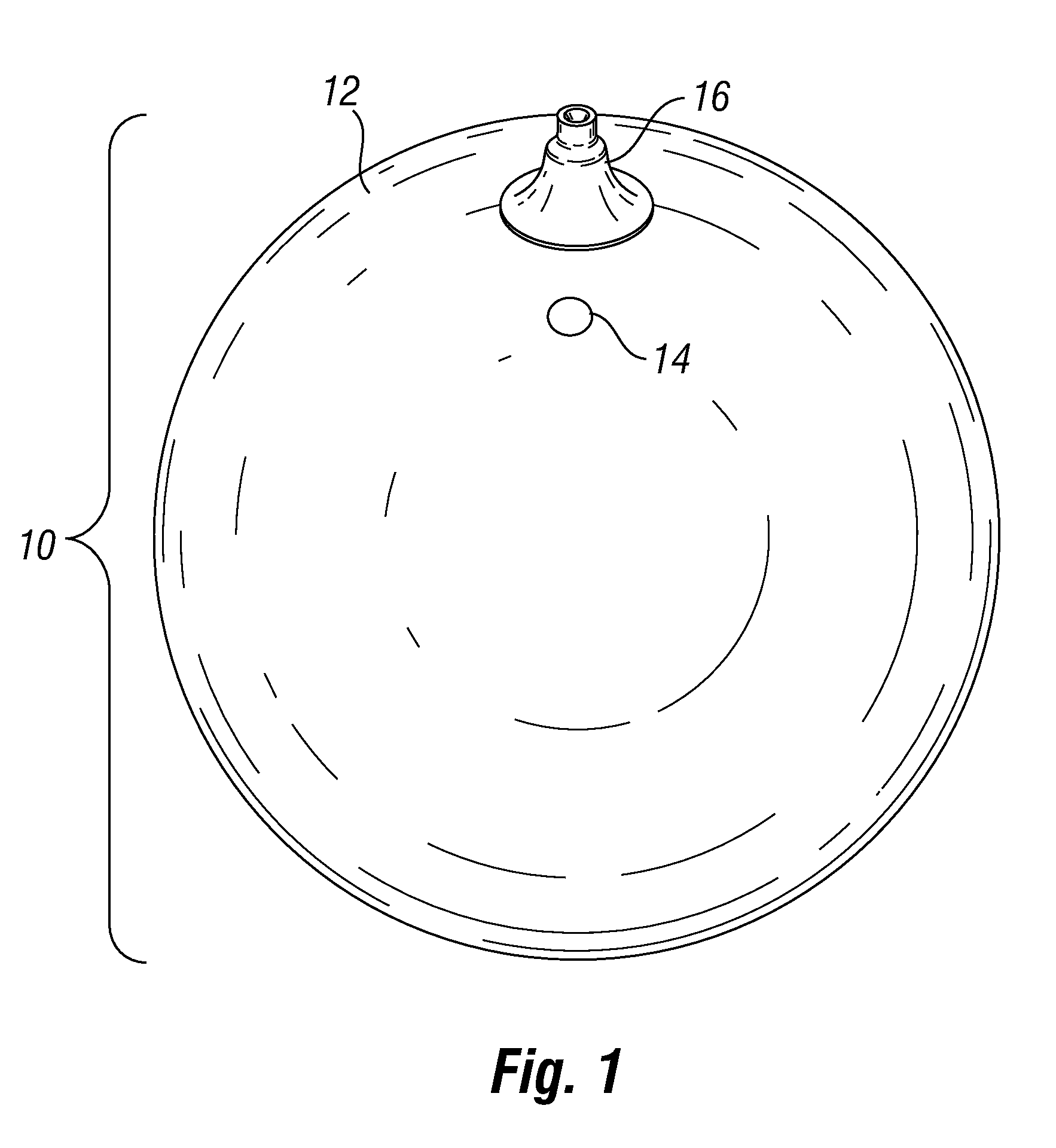 Remote deflation of intragastric balloon