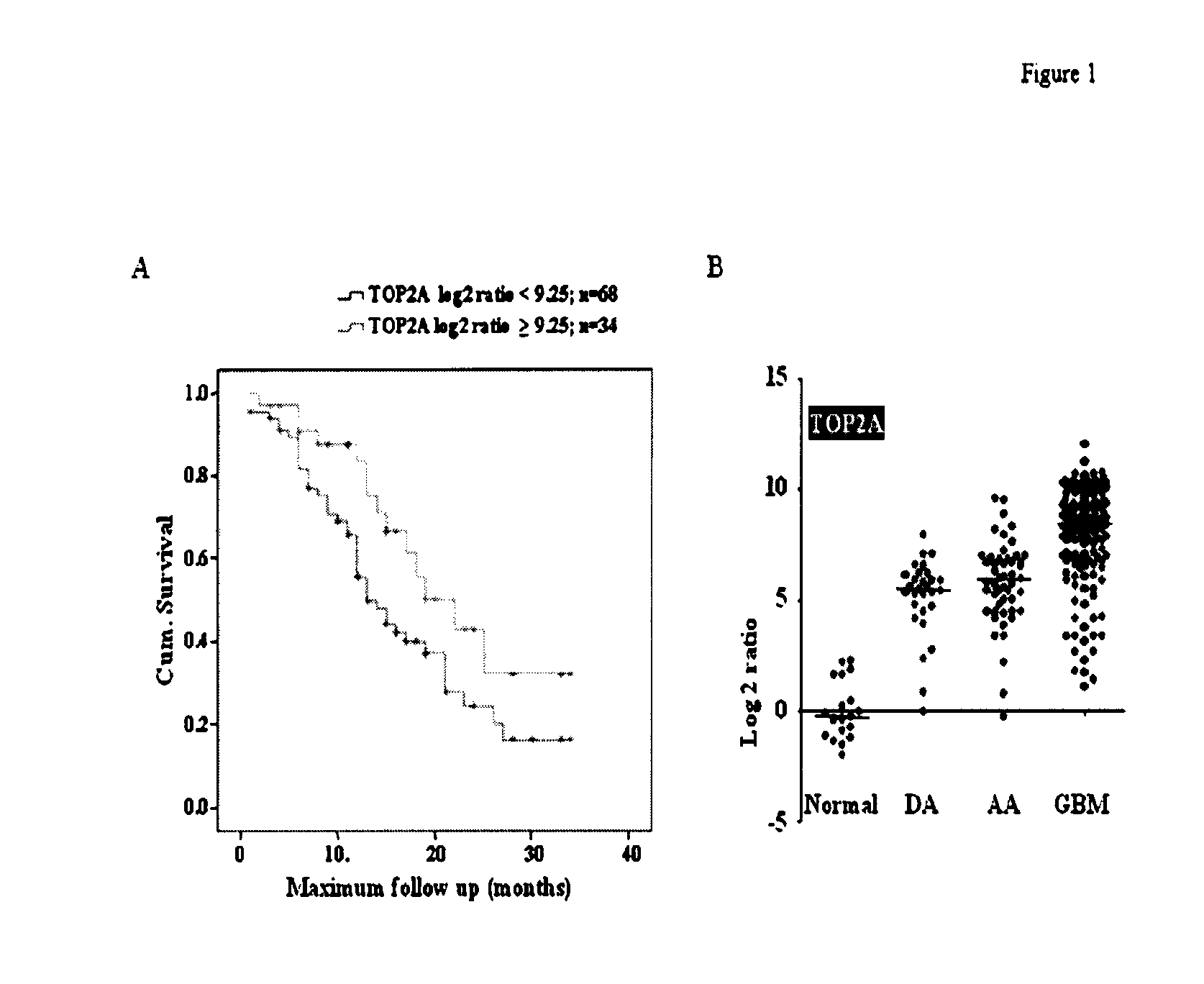 Top2a inhibition by temozolomide and its predictive value of gbm patients survival