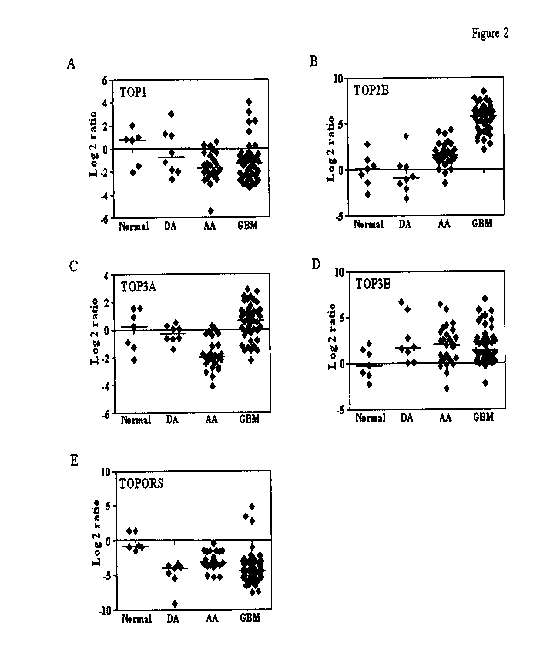 Top2a inhibition by temozolomide and its predictive value of gbm patients survival