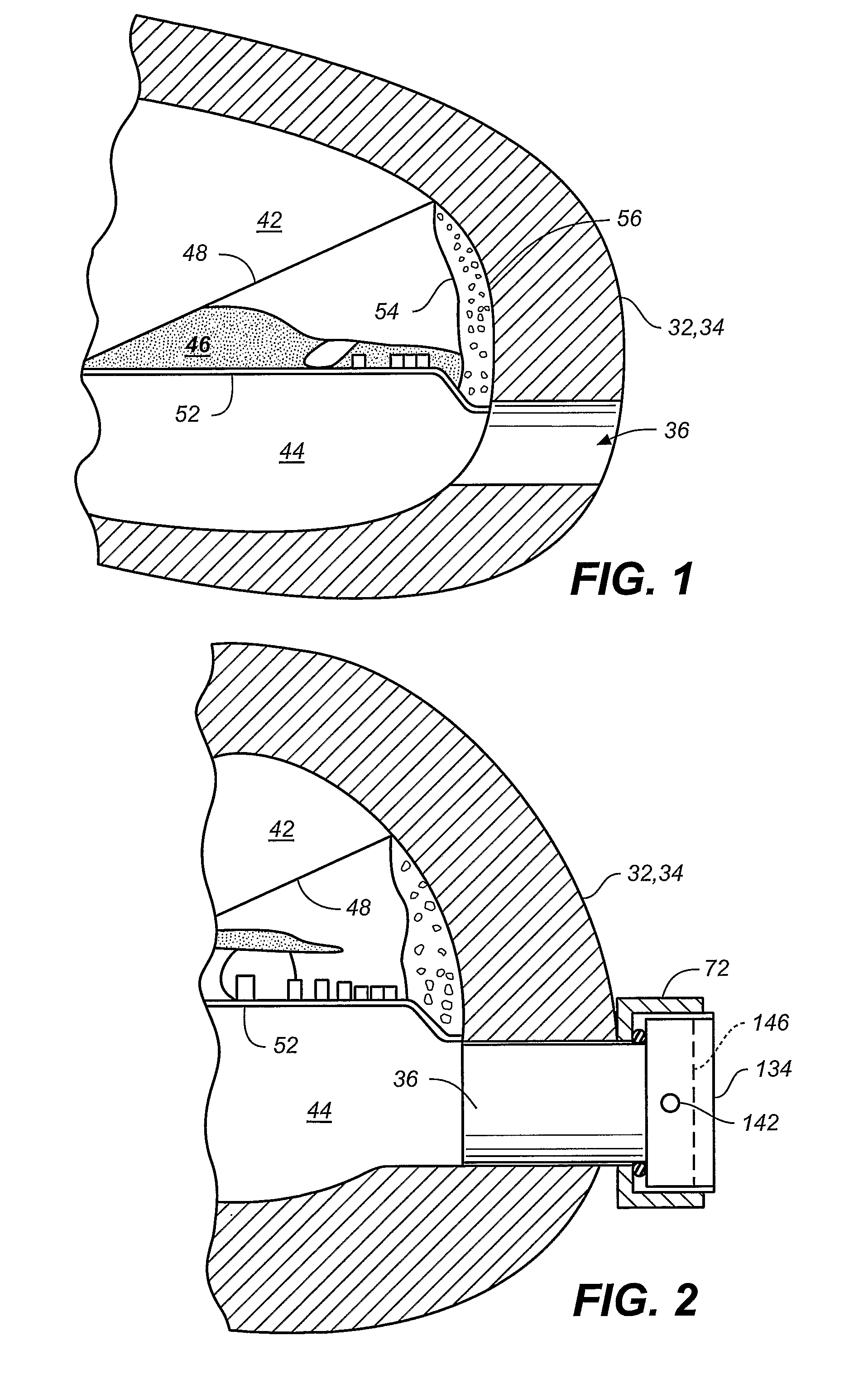 Implanting a Therapeutic Appliance Into the Cochlea