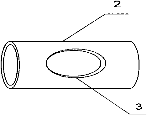 Magnetic device used for cardia-esophagogastric varices sugiura