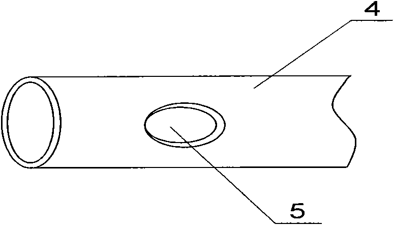 Magnetic device used for cardia-esophagogastric varices sugiura