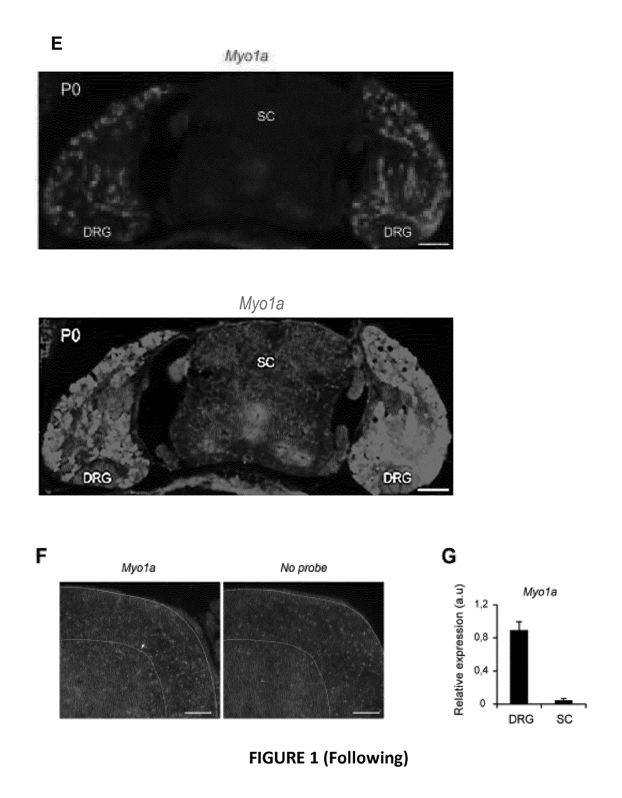 Myo1a for predicting conversion of acute pain into chronic pain and use of myo1a for therapy of pain