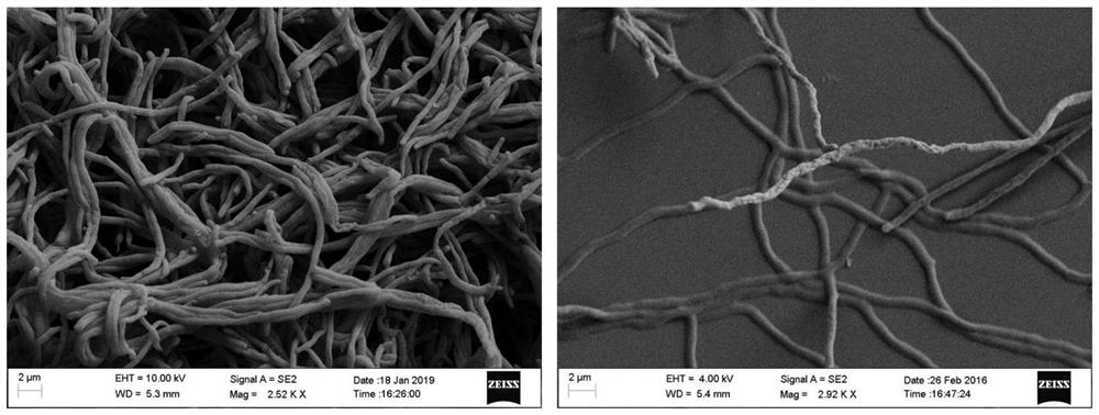 Streptomyces hupehensis and application thereof