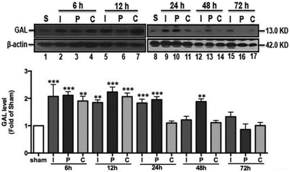 Application of galanin to preparation of reagent for preventing cerebral ischemic stroke