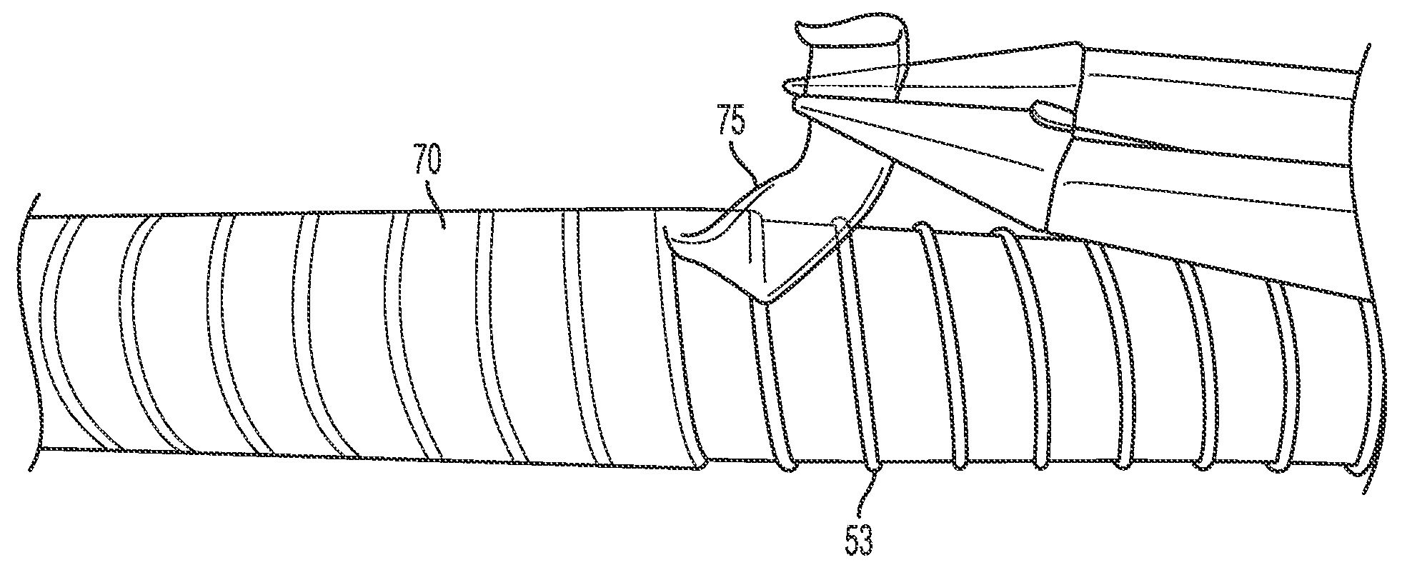 Externally reinforced percutaneous gastrostomy tube with customizable smooth tube length