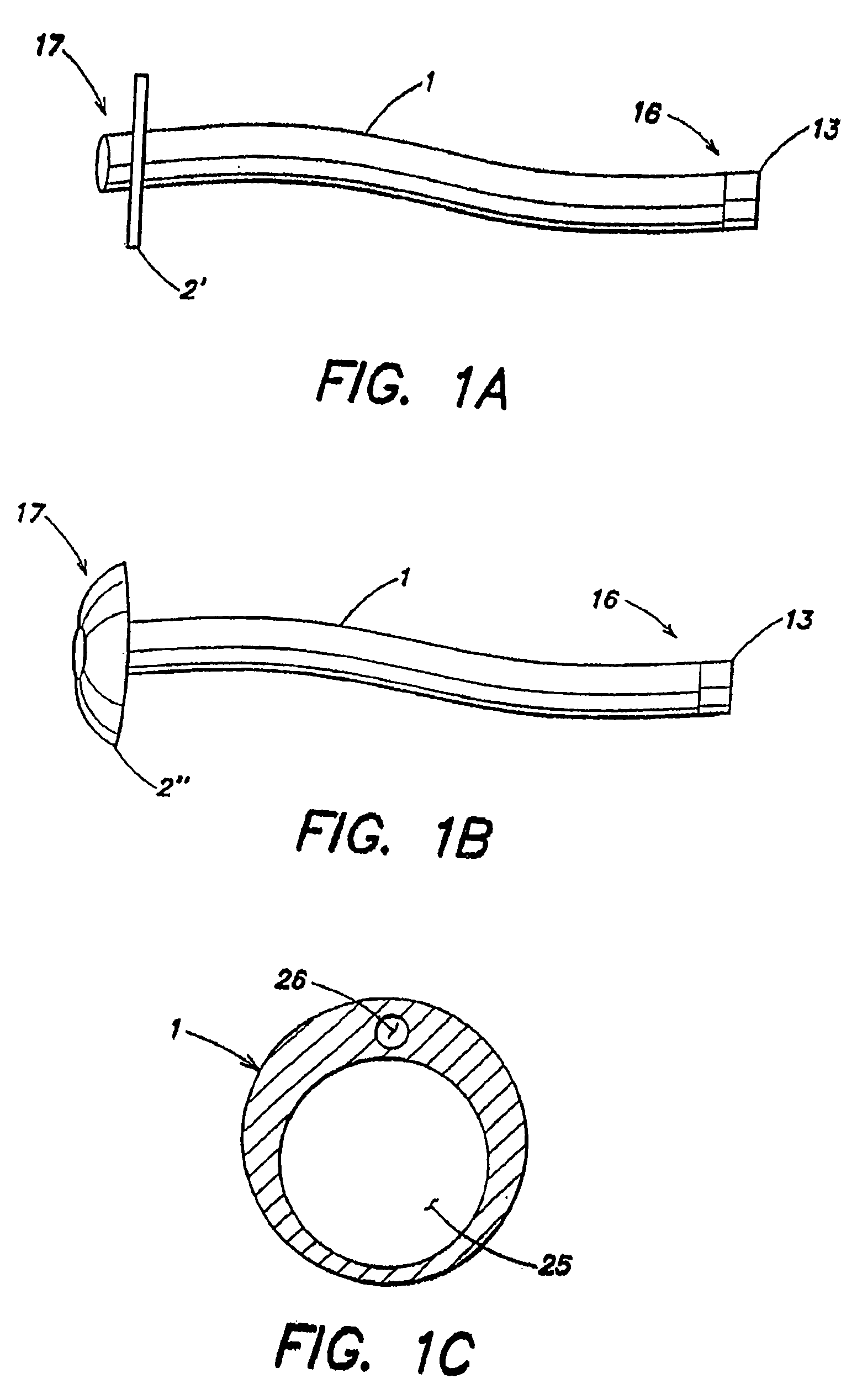 Externally reinforced percutaneous gastrostomy tube with customizable smooth tube length