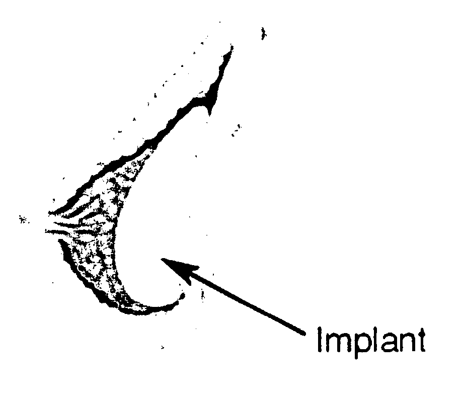 Compositions for breast implant filling and methods of use