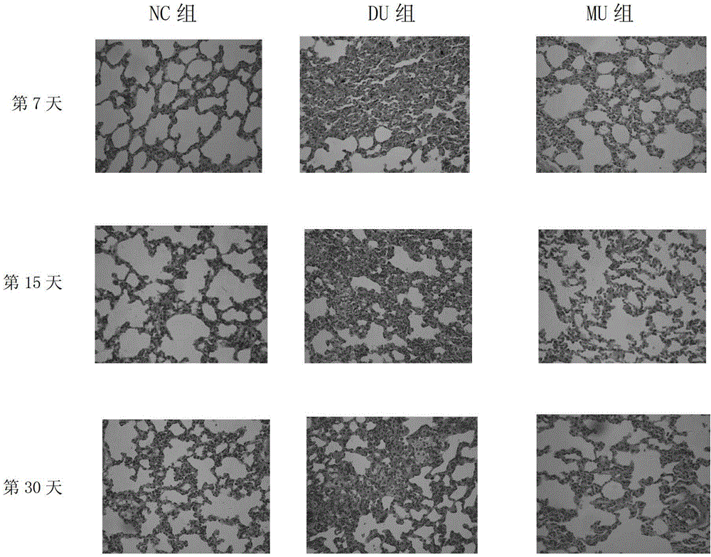 Application of Mucosolvan in preparing product for cleaning depleted uranium particles in lung