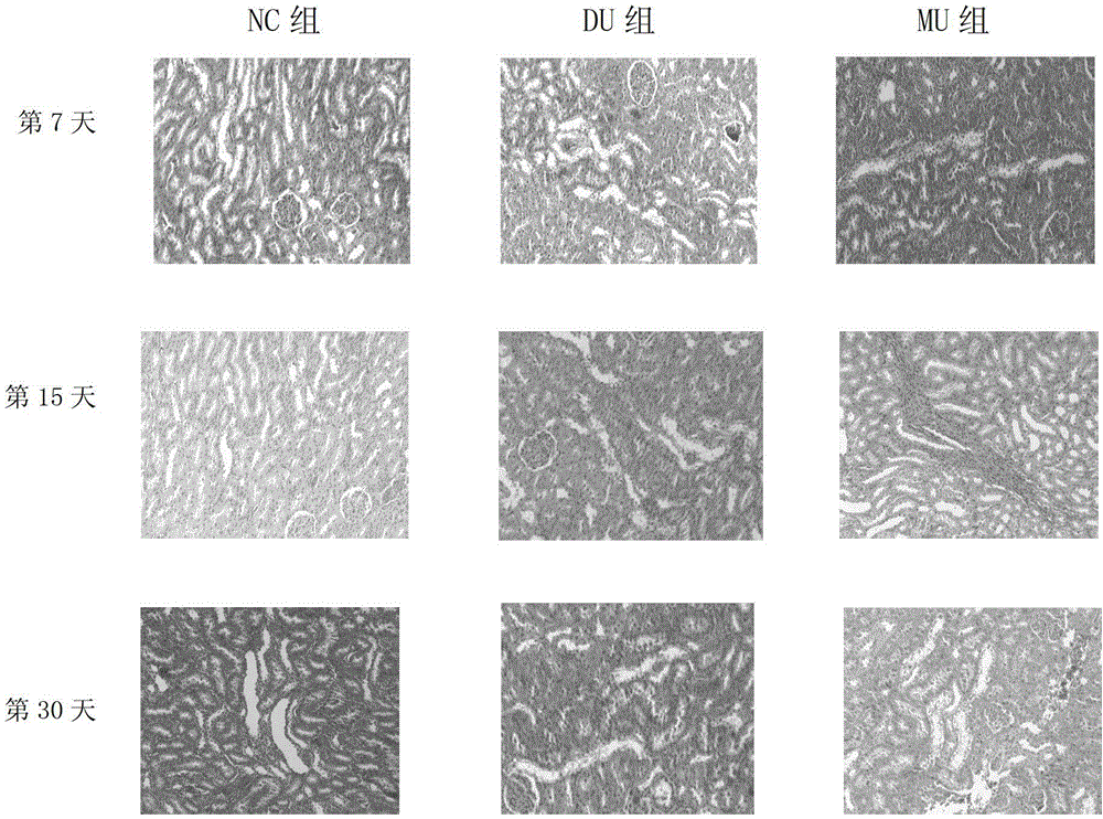 Application of Mucosolvan in preparing product for cleaning depleted uranium particles in lung