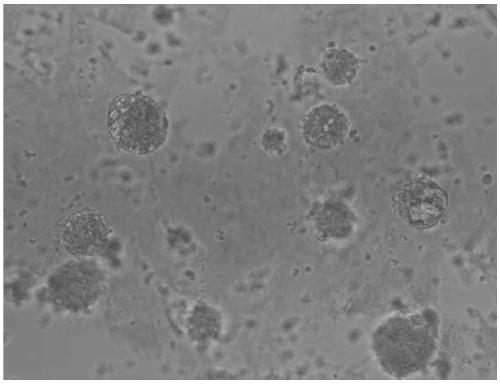 Culture medium for 3D culture of ovarian cancer tissue