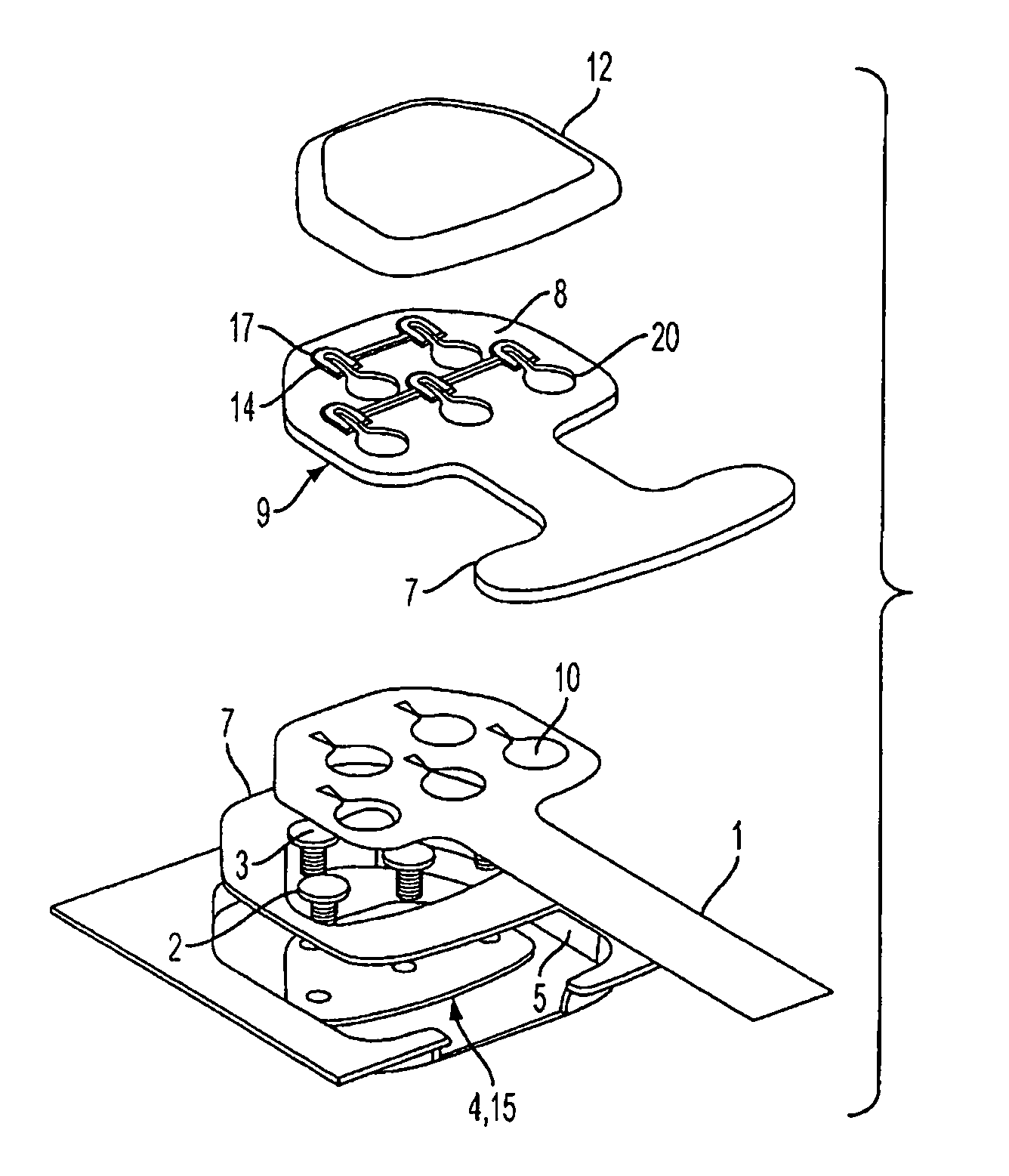 Multi-lead keyhole connector