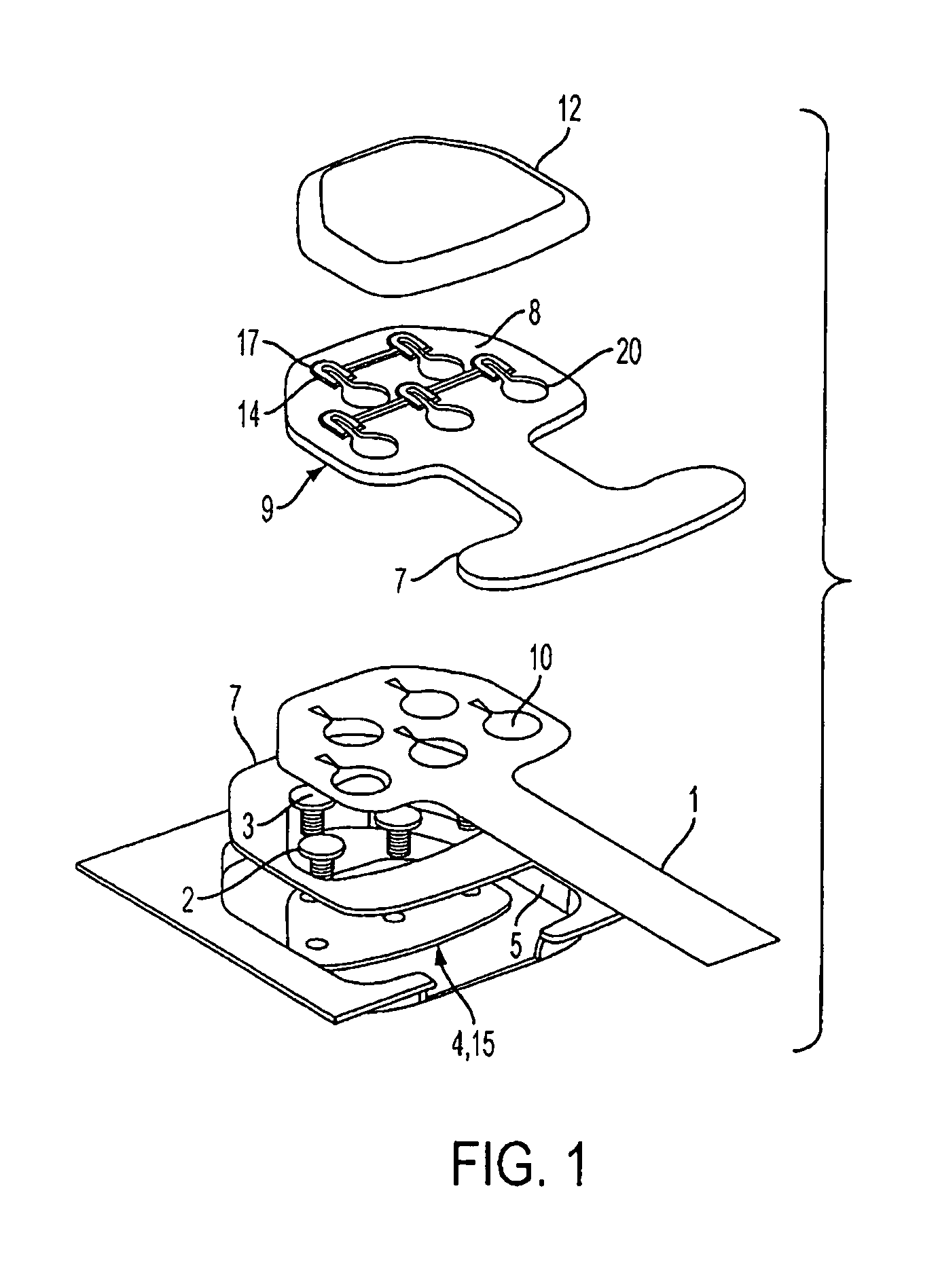 Multi-lead keyhole connector