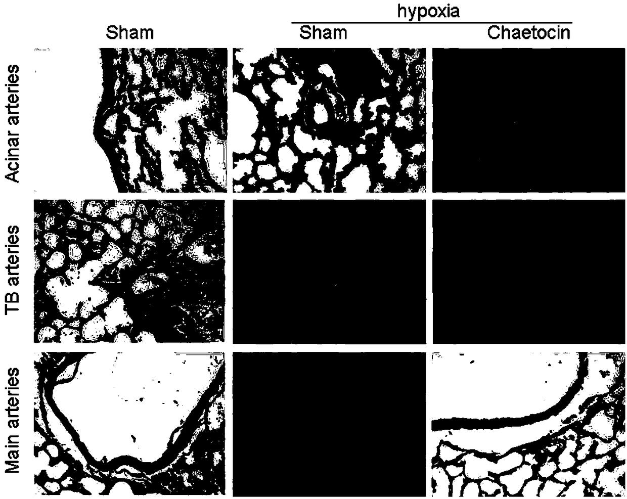 Application of chaetocin in preparation of drugs for preventing and treating hypoxic pulmonary hypertension