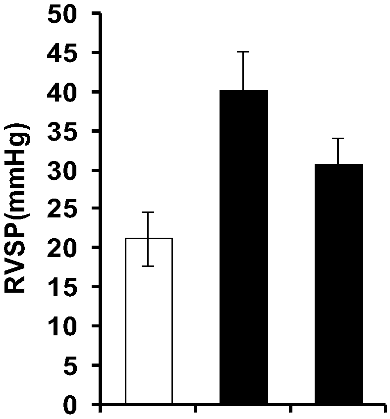 Application of chaetocin in preparation of drugs for preventing and treating hypoxic pulmonary hypertension