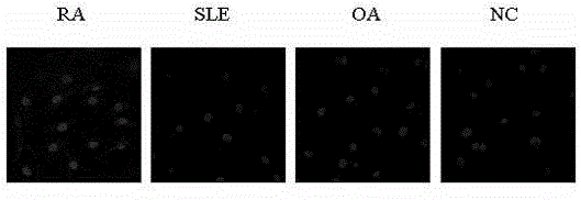 Application of fibroblast-like synoviocytes in preparation of rheumatoid arthritis (RA) diagnosis reagent