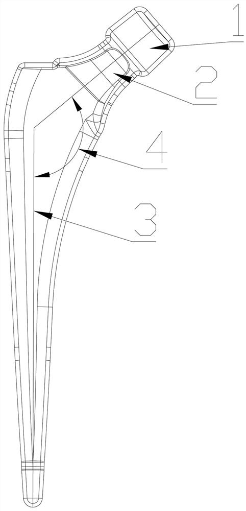 Forging method for alloy femoral component forged part