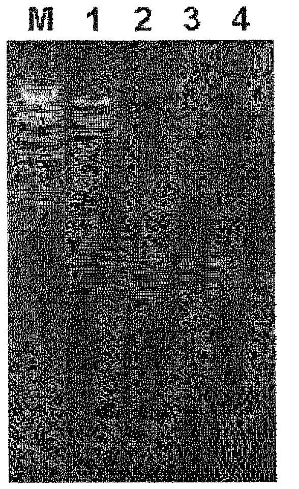 Microorganism-derived psychrophilic endonuclease