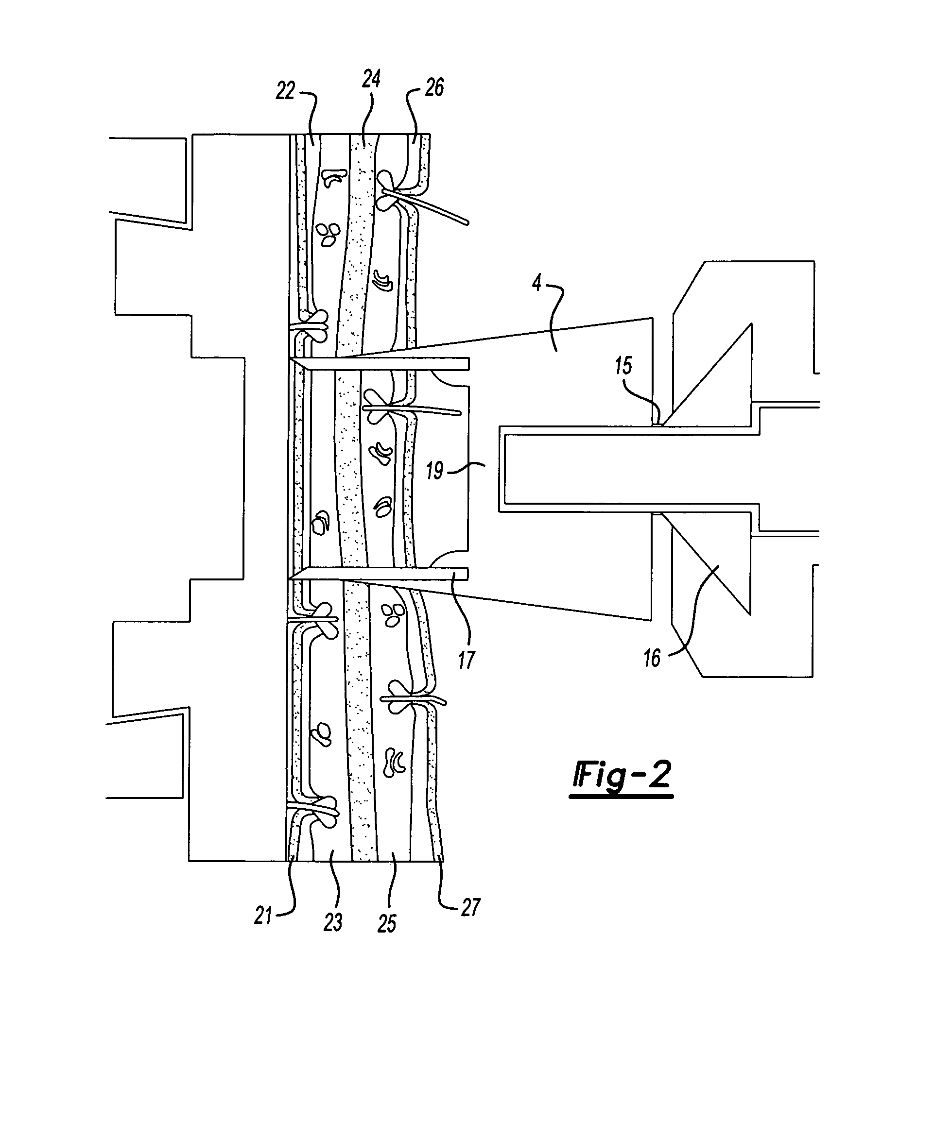 Modified ear tags and method for removing tissue