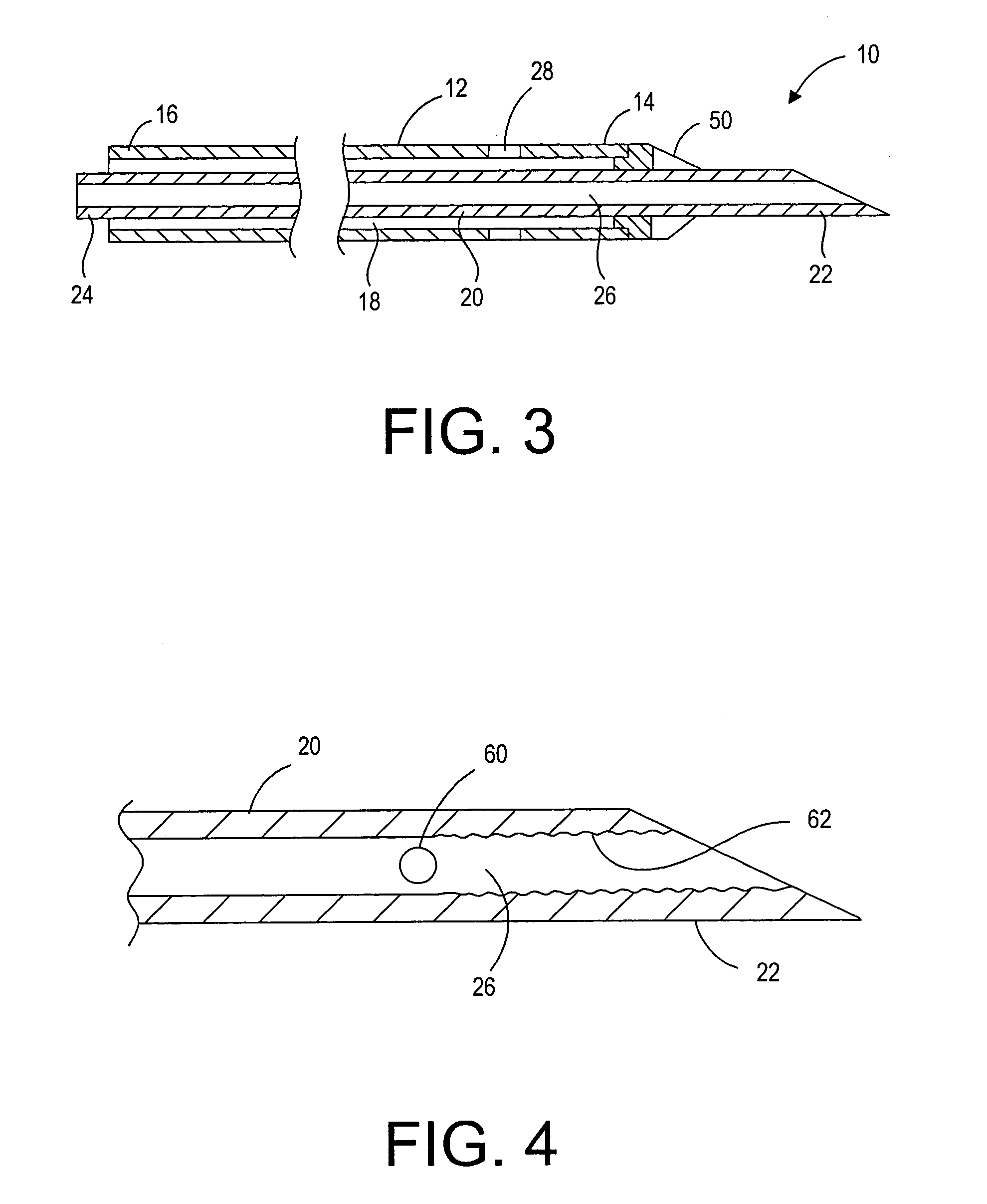 Devices and methods for delivering therapeutic or diagnostic agents