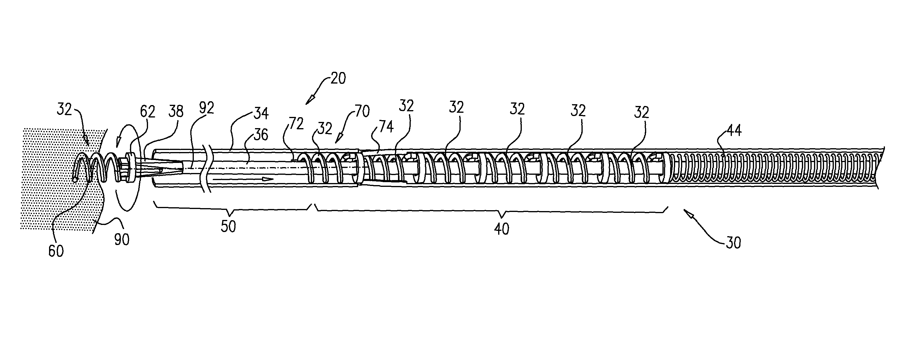 Multiple anchor delivery tool
