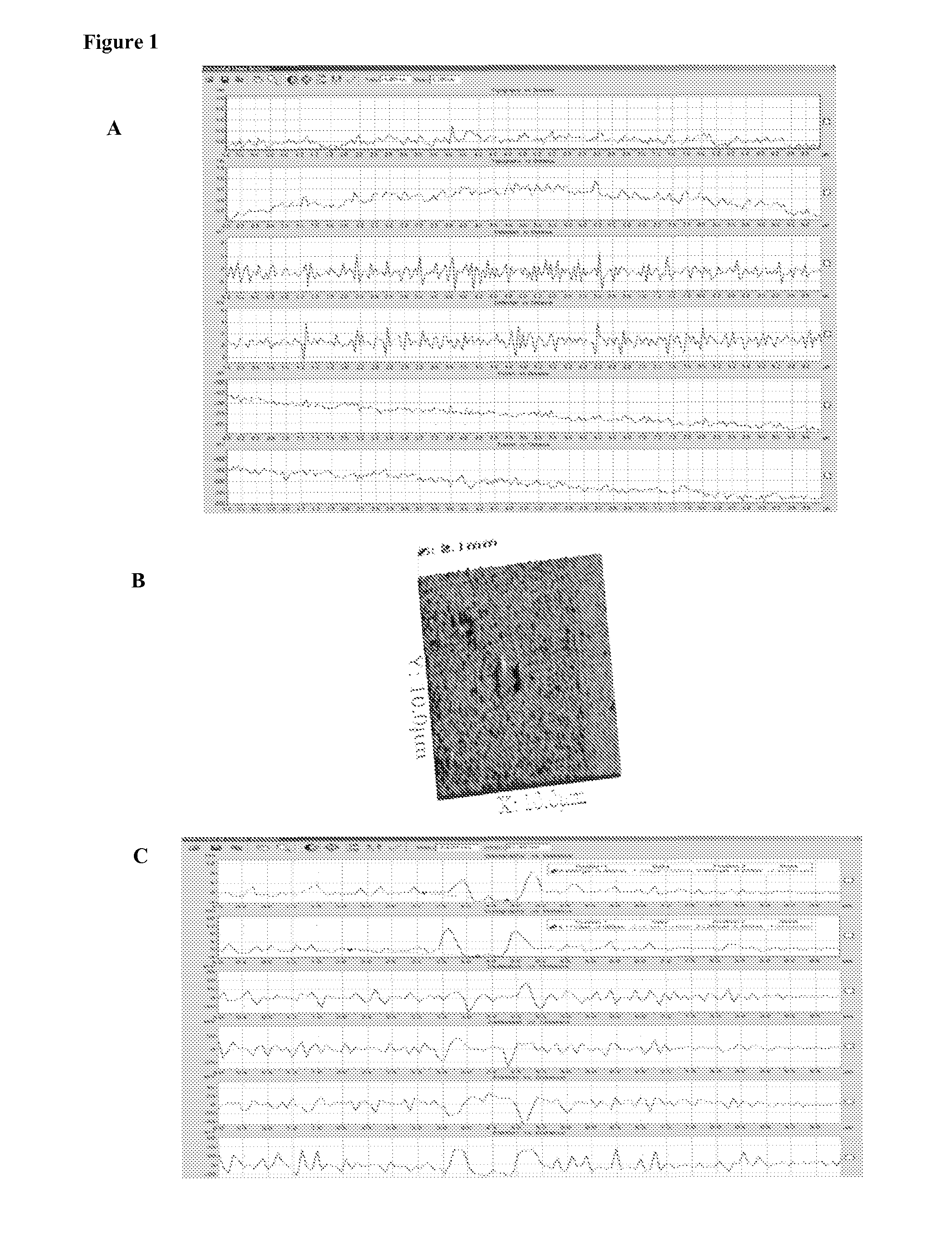 Biocoated piezoelectric biosensor platform for point-of-care diagnostic use