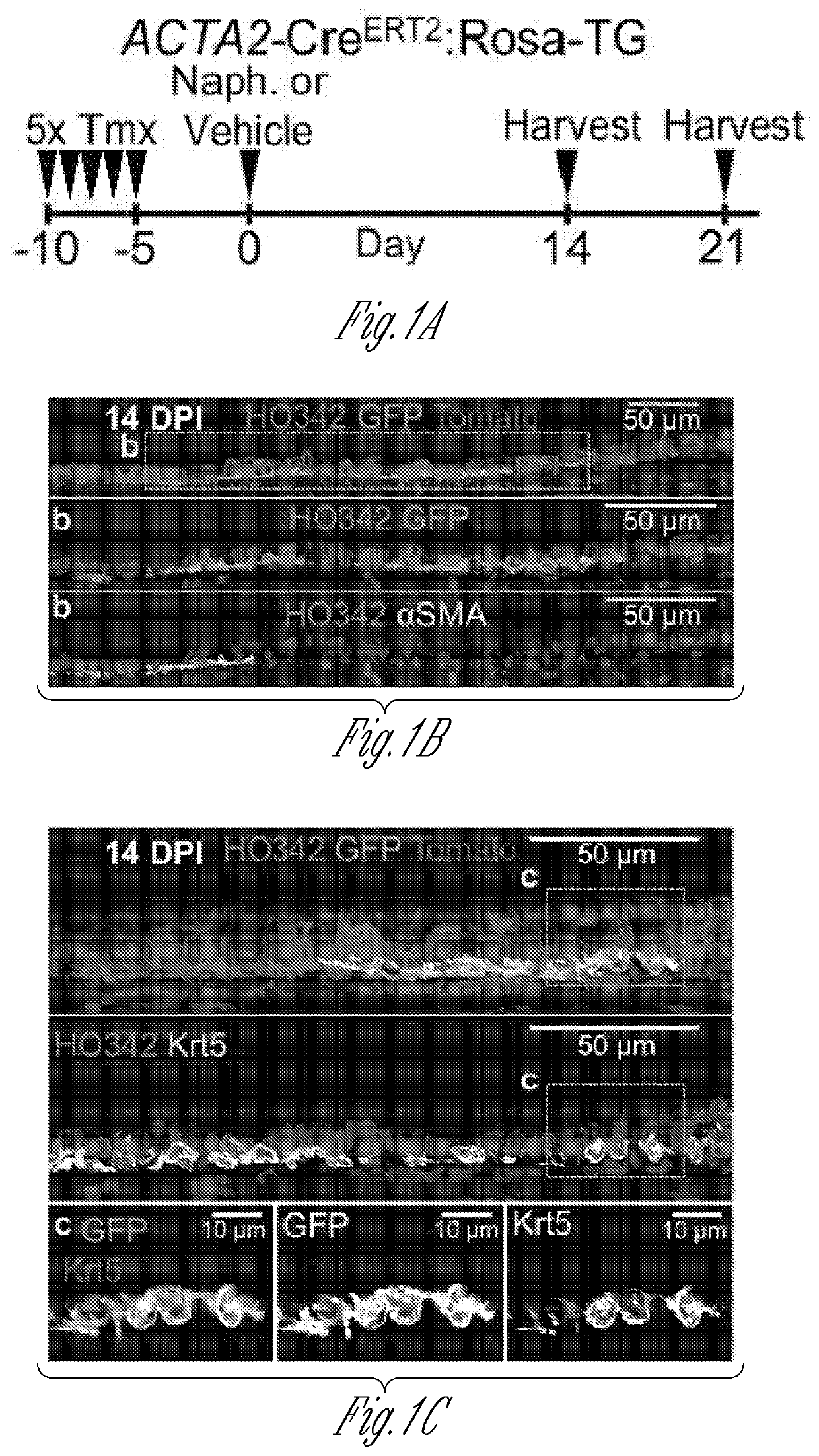 Inductive regeneration of the airway by transcriptional factor modulation of glandular myoepithelial stem cells