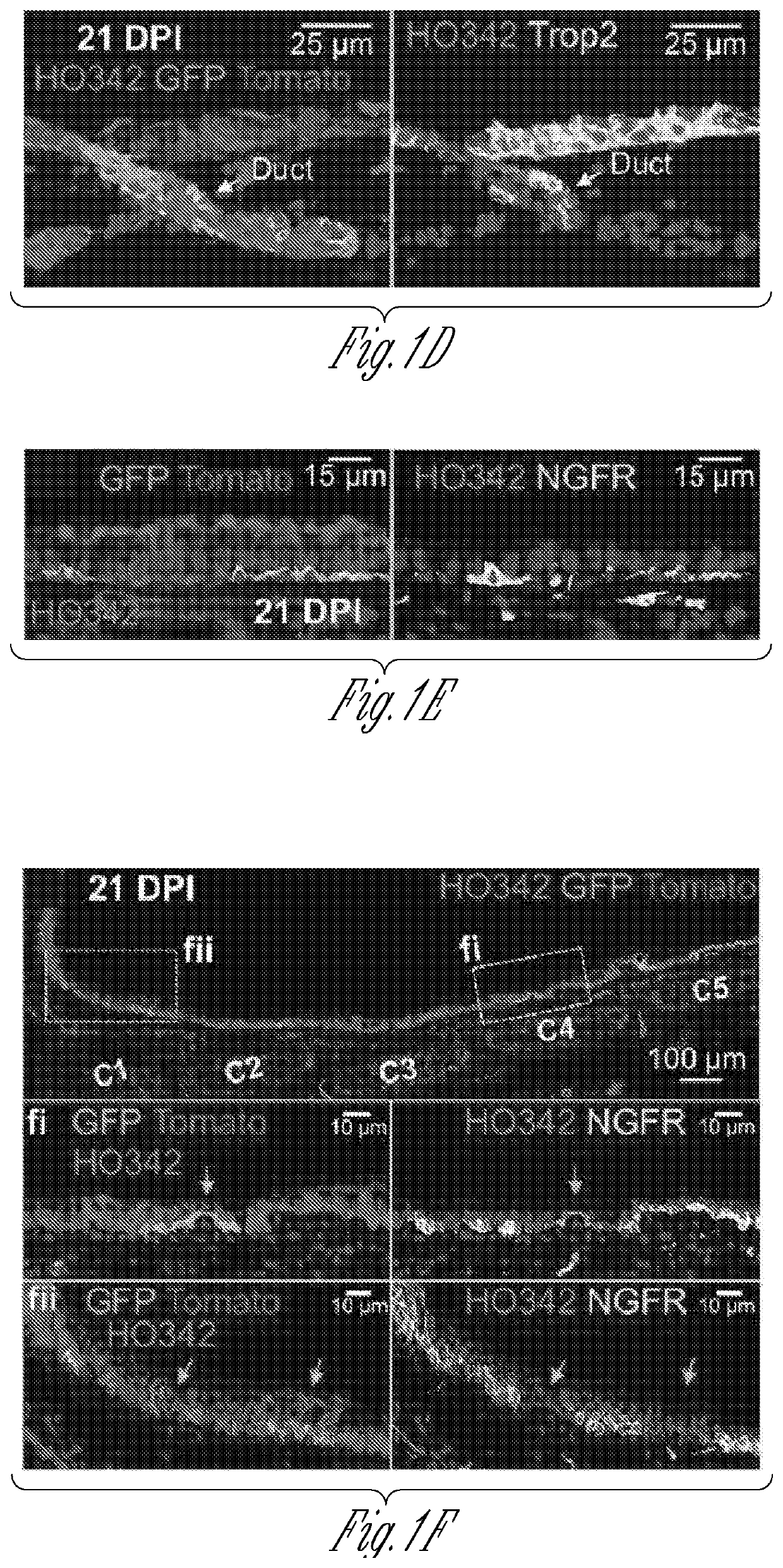 Inductive regeneration of the airway by transcriptional factor modulation of glandular myoepithelial stem cells