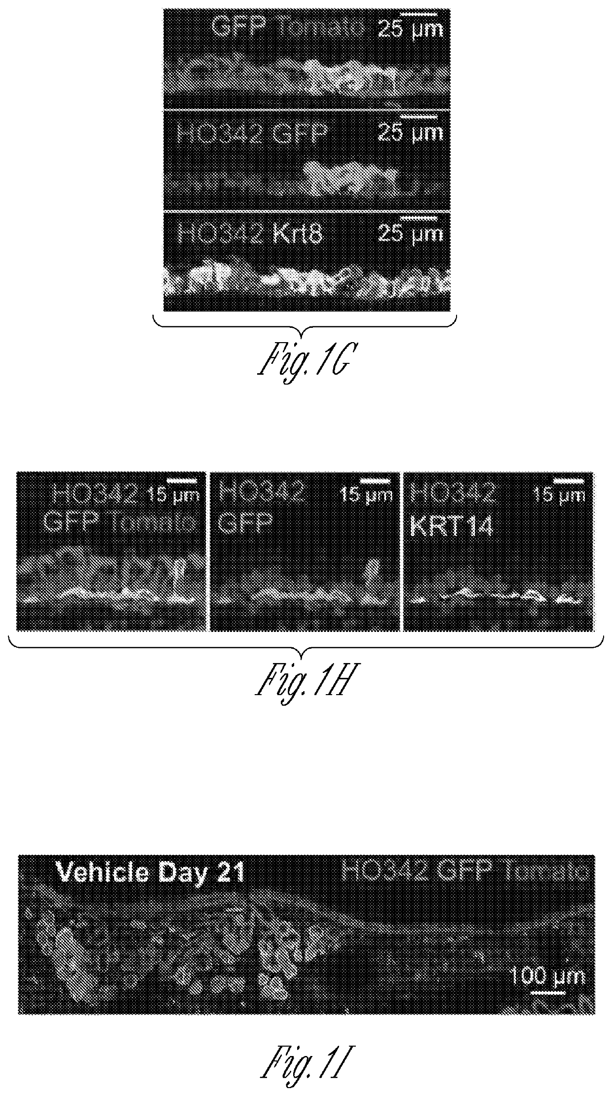 Inductive regeneration of the airway by transcriptional factor modulation of glandular myoepithelial stem cells