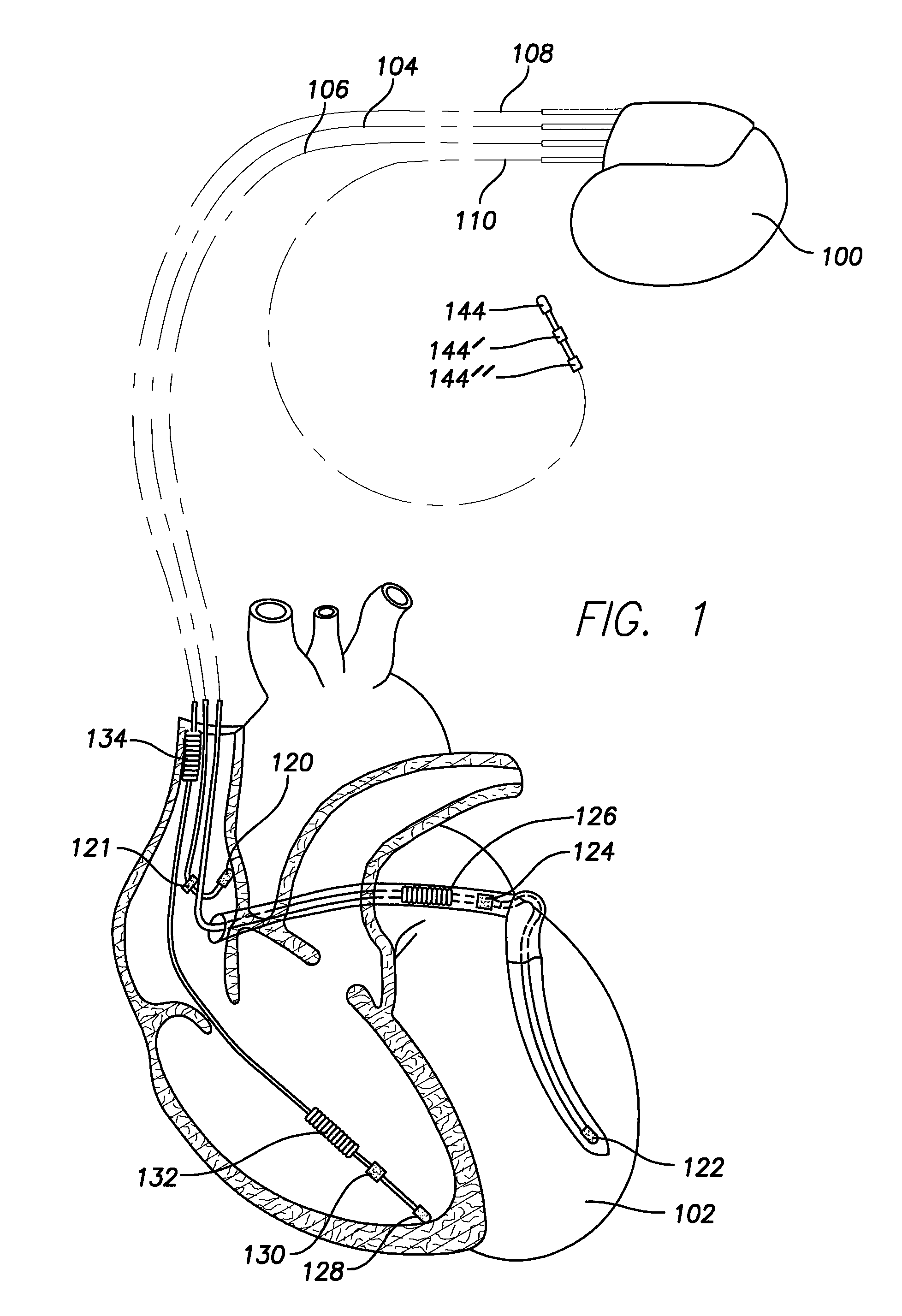 Small caliber implantable biometric leads and cables for same