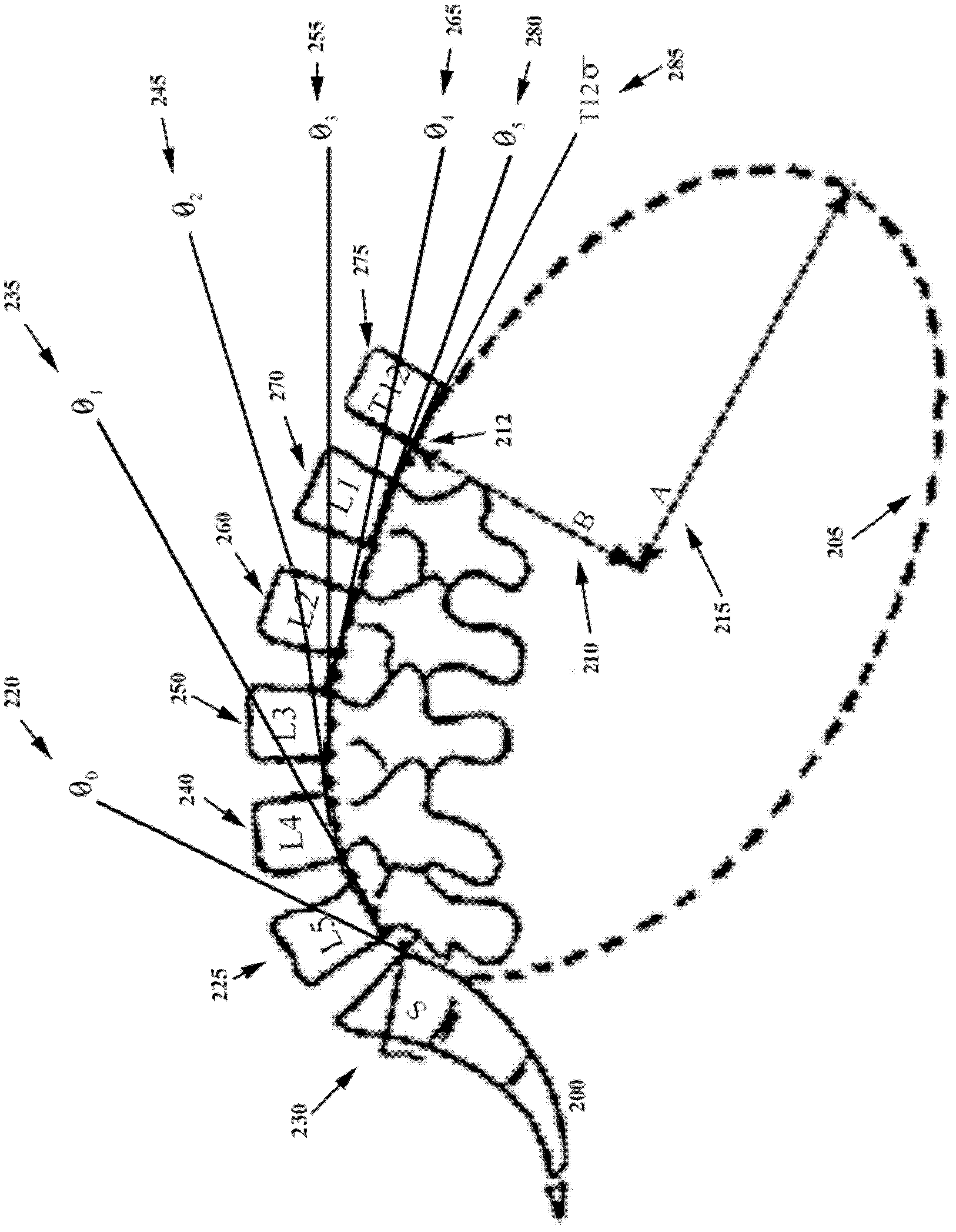 System capable of enabling difference realignment to be carried out on spinal column under tensile force