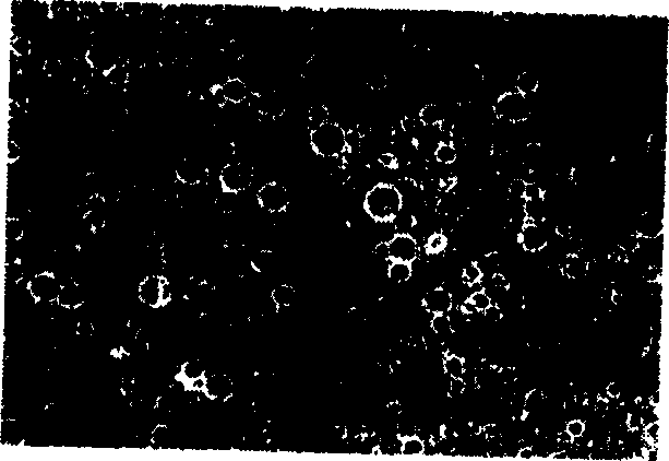 Preparation technique of protein medicine microsphere carrier with small grain size