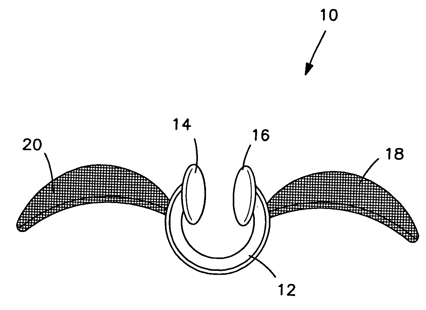 Disposable nasal filter