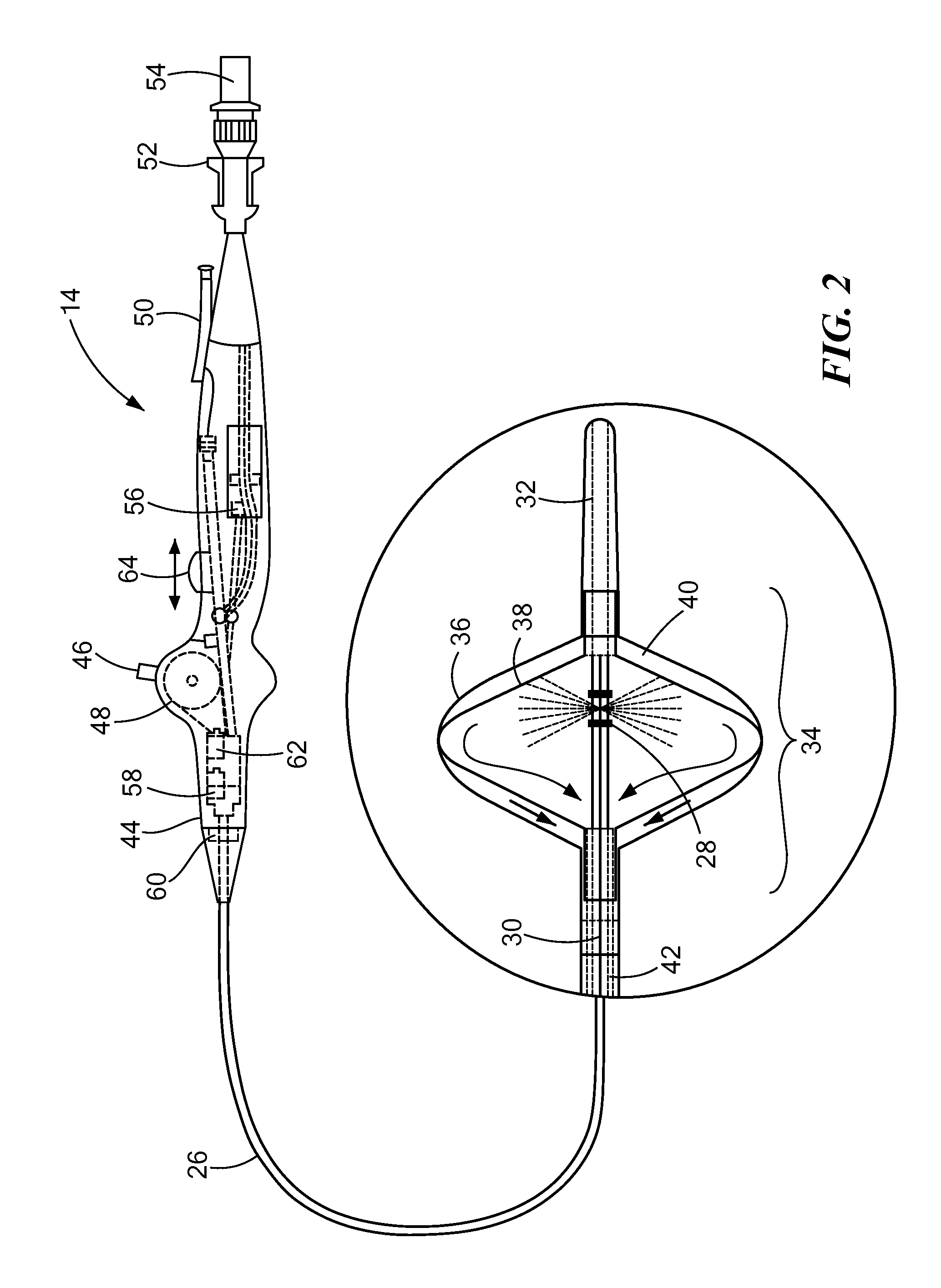 Endoluminal ablation cryoballoon and method