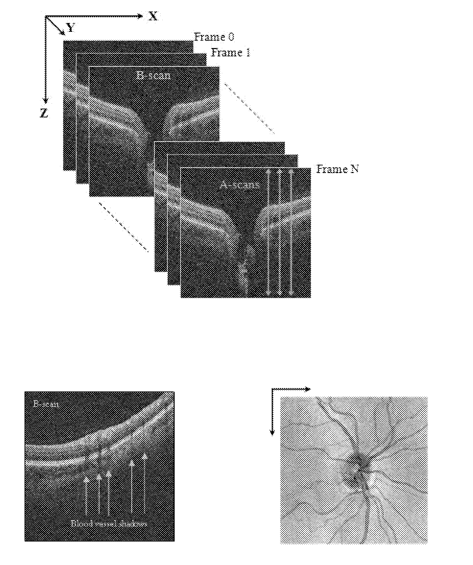 Blood vessel segmentation with three dimensional spectral domain optical coherence tomography