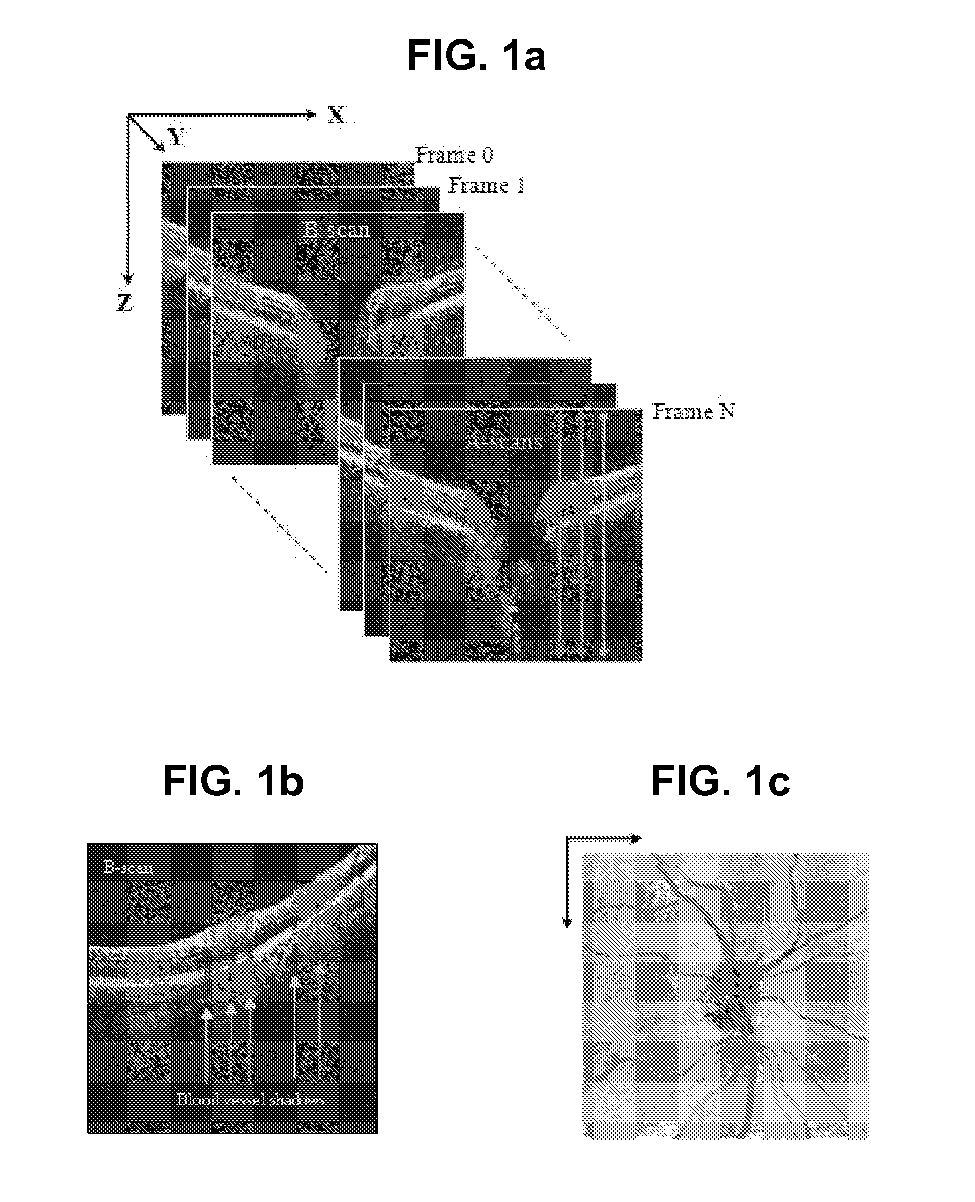 Blood vessel segmentation with three dimensional spectral domain optical coherence tomography