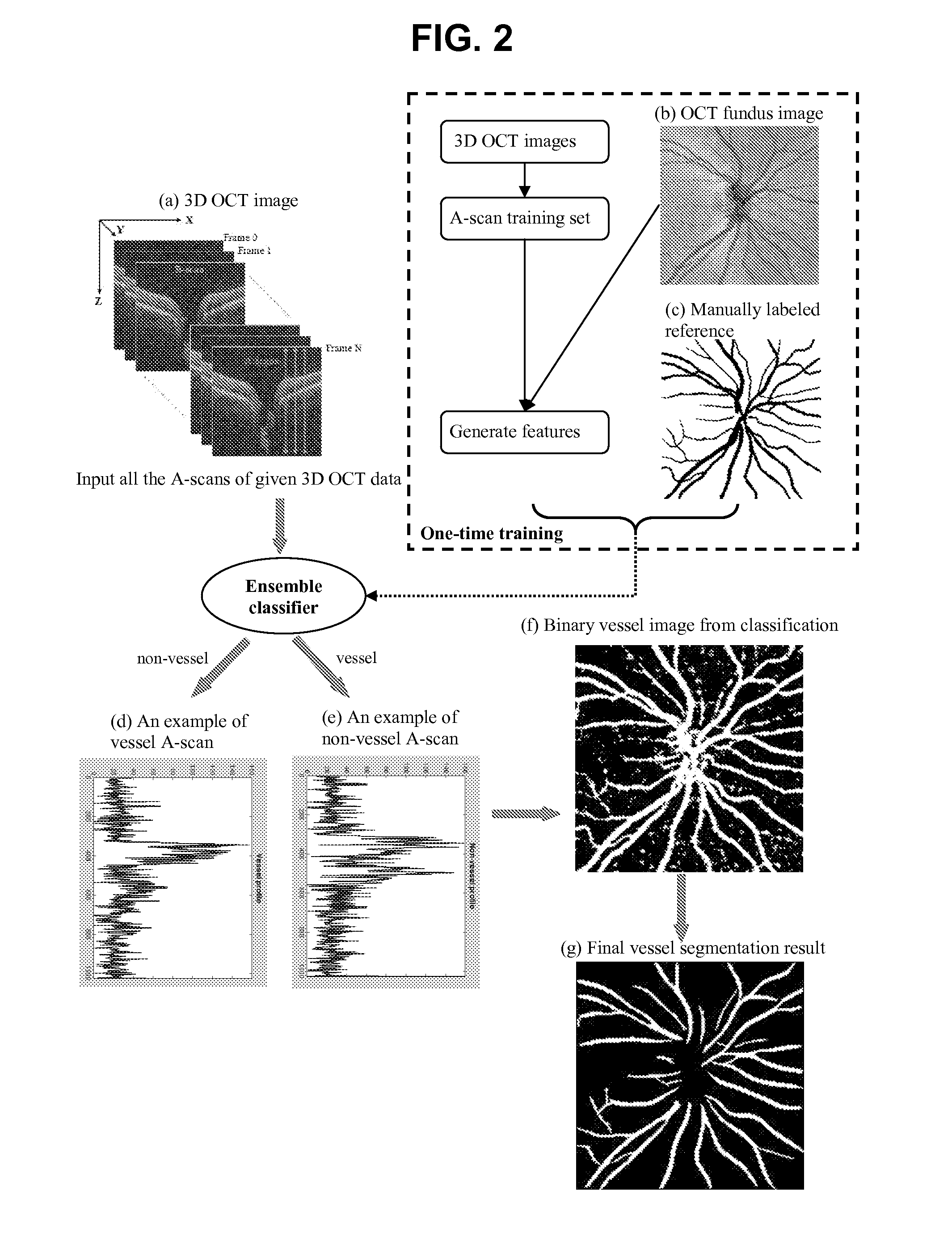 Blood vessel segmentation with three dimensional spectral domain optical coherence tomography