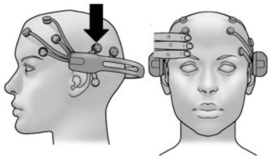 Brain-computer interface rehabilitation training system and method