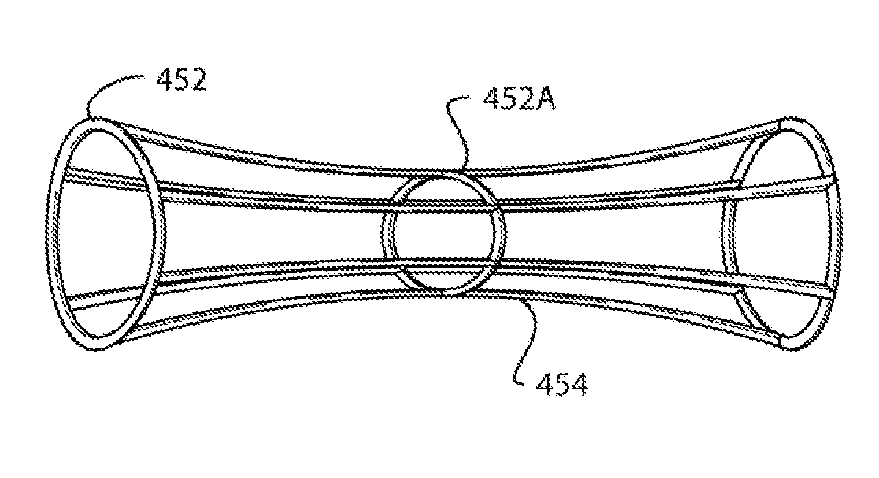 Prosthetic Conduit With Radiopaque Symmetry Indicators