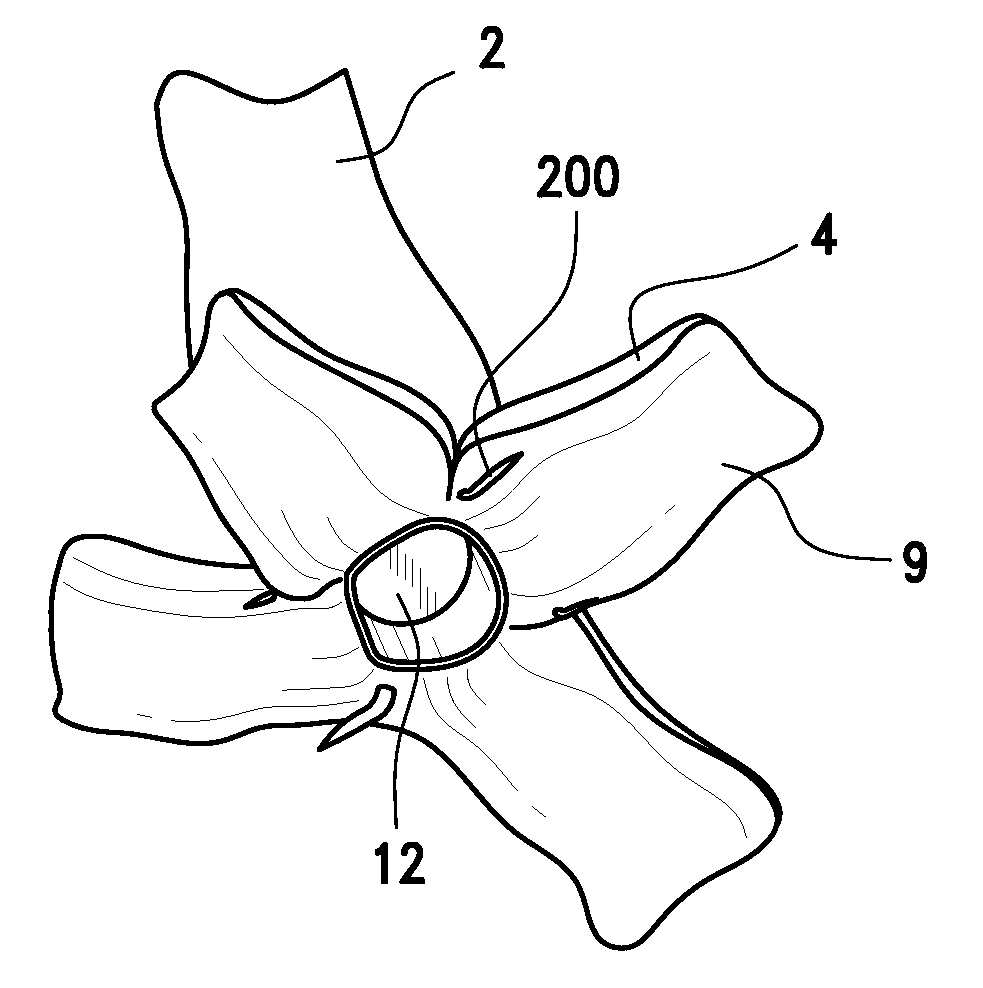 Device and method for joining vessels in anastomosis