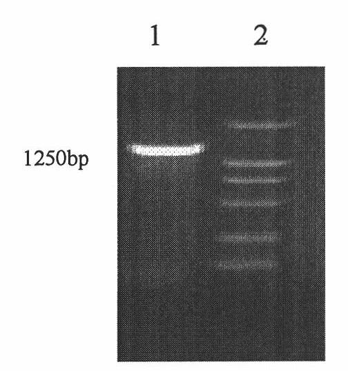 Anti-glutamate dehydrogenase protein monoclonal antibody, preparation method thereof and use thereof