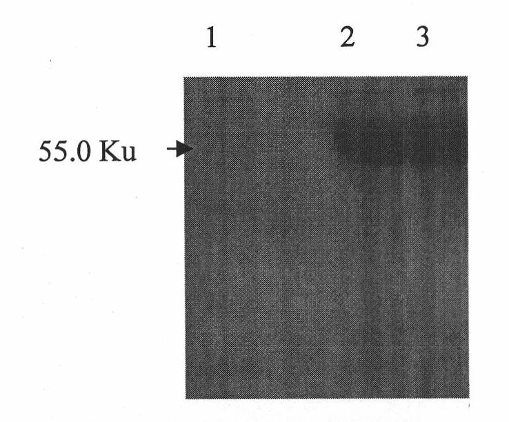 Anti-glutamate dehydrogenase protein monoclonal antibody, preparation method thereof and use thereof